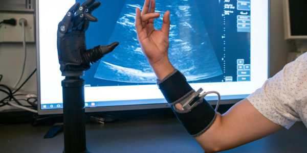 Mason’s Center for Adaptive Systems of Brain-Body Interactions bridges neuroscience, engineering, and rehabilitation to improve mobility. One project uses ultrasound technology to improve control of prosthetics, allowing for more dexterity.